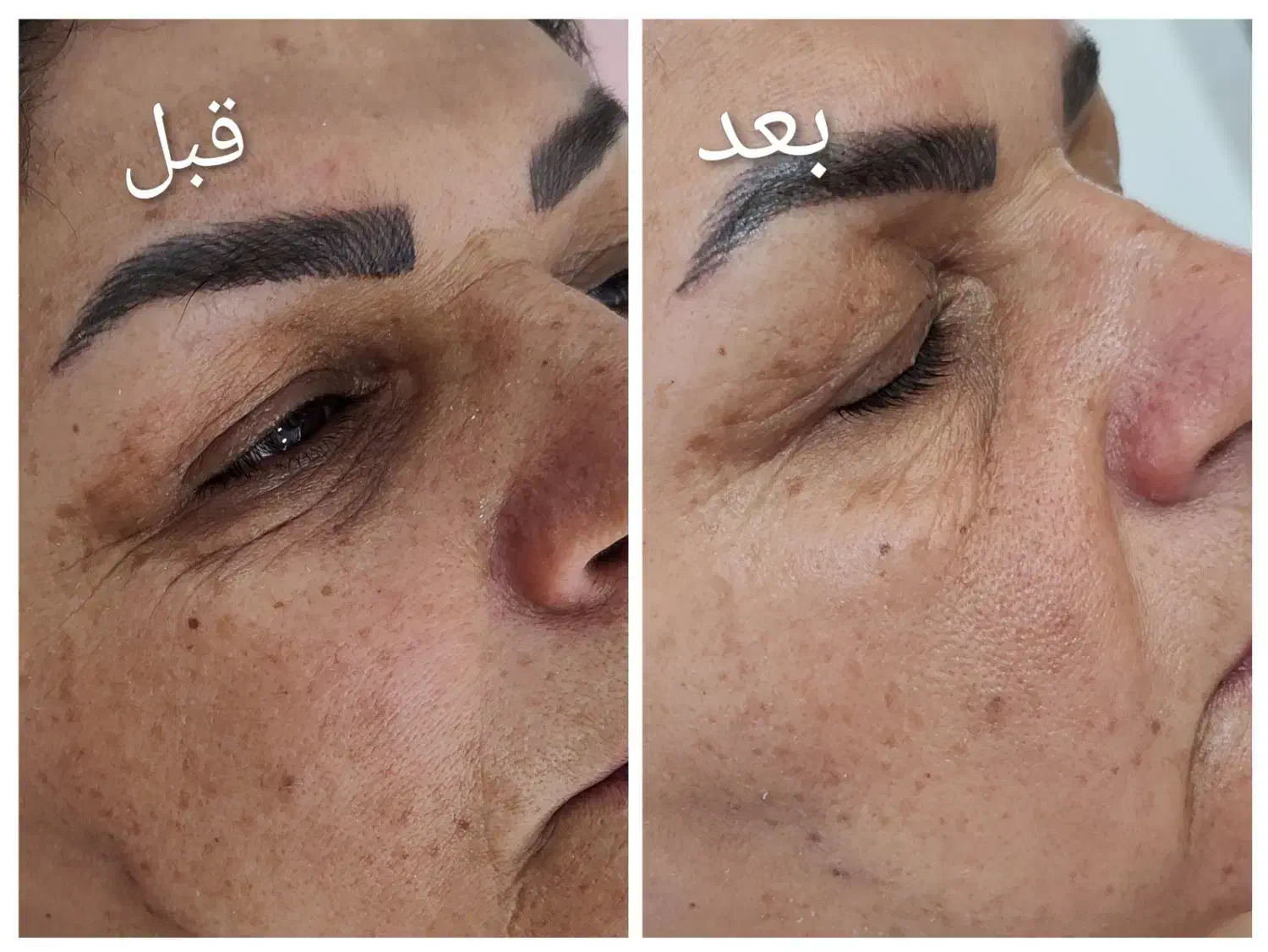 فیشیال تخصصی|خدمات آرایشگری و زیبایی|محمدشهر, محمدشهر|دیوار