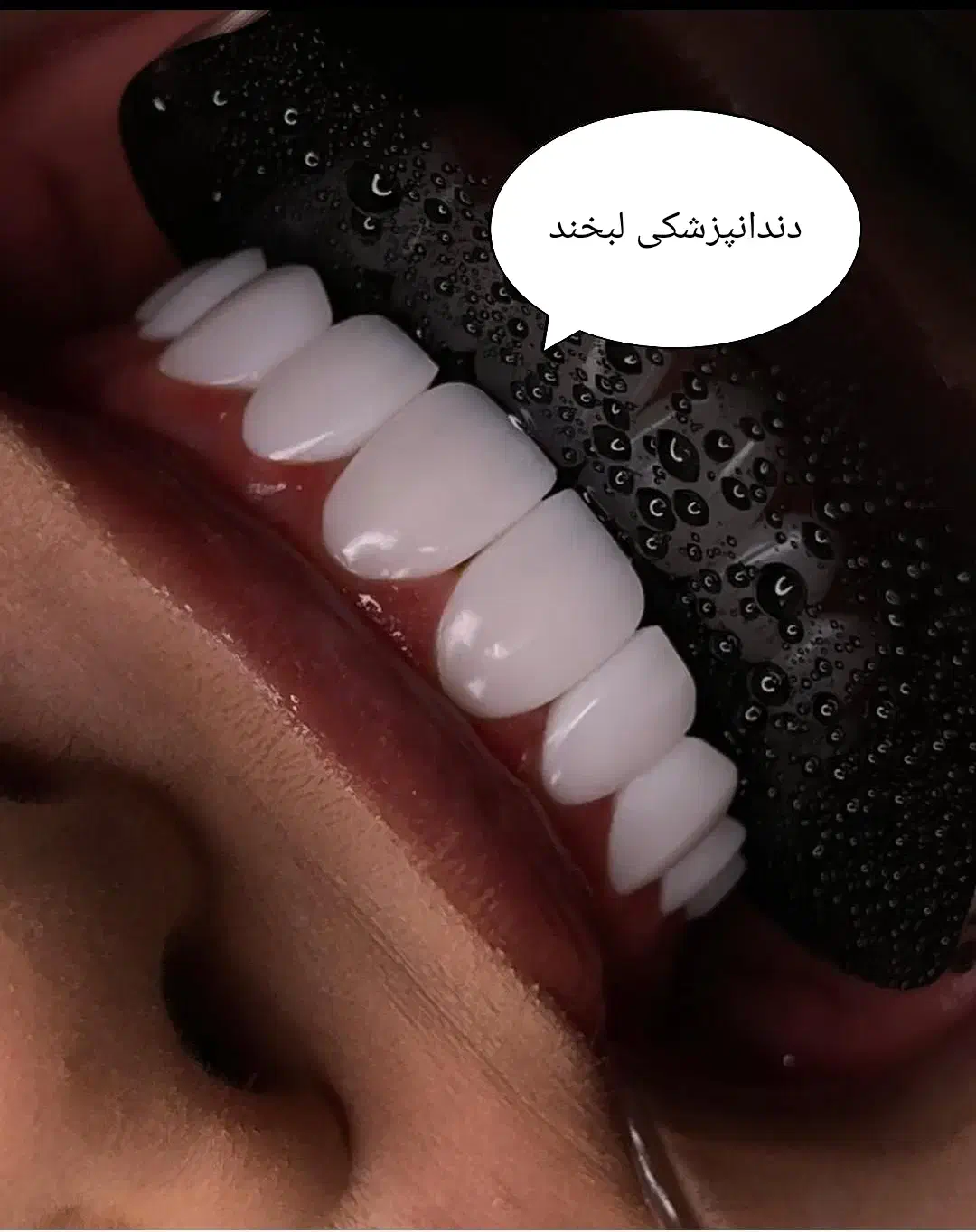 خدمات دندانپزشکی (بانرخ تامین اجتماعی )|خدمات آرایشگری و زیبایی|تبریز, |دیوار