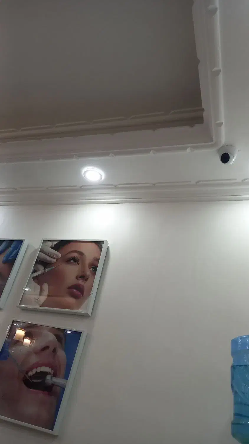 گچکاری ولکه گیری|خدمات پیشه و مهارت|بوشهر, |دیوار