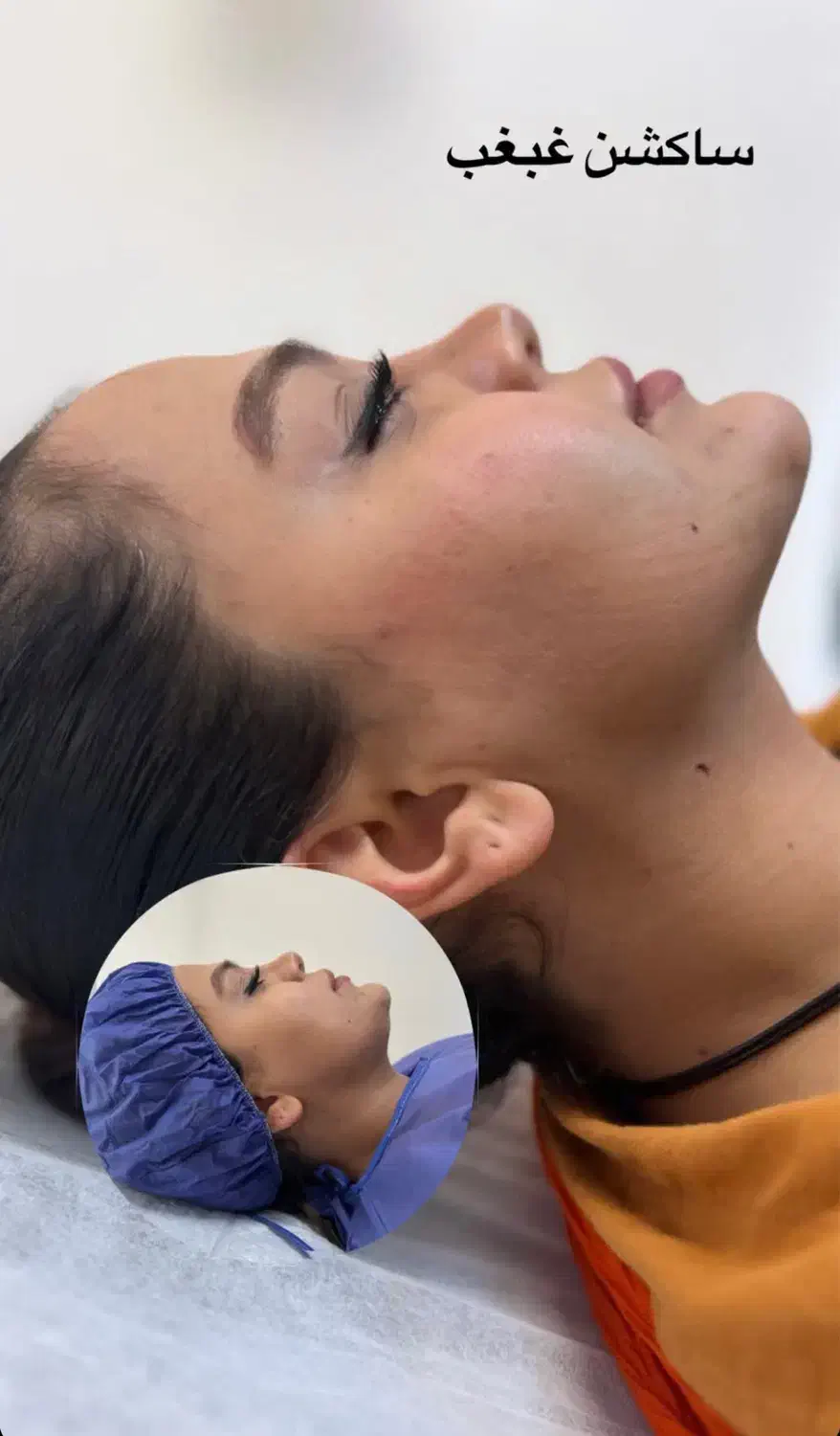 جراحی زیبایی با قیمت فوق العاده مناسب|خدمات آرایشگری و زیبایی|ساری, |دیوار