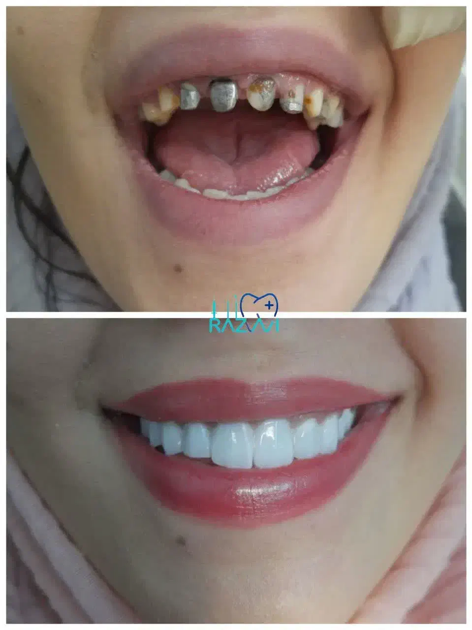 دندانپزشکی دکتر رضوی|خدمات آرایشگری و زیبایی|قم, چهار امامزاده|دیوار