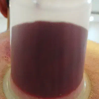 پرستارطب سنتی حجامت بادکش تزریقات درمنزل|خدمات آرایشگری و زیبایی|مشهد, گلبرگ شمالی|دیوار