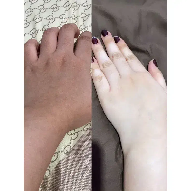 کرم تضمینی جواب نگرفتی پولتوپس بگیر|آرایشی، بهداشتی، درمانی|امیدیه, |دیوار