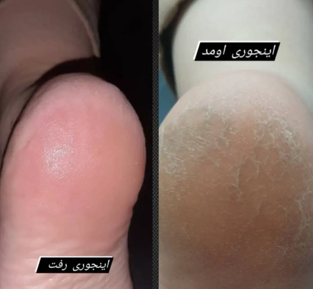 پارافین تراپی وپدیکوروکفسابی پاویژه آقایون وبانوان|خدمات آرایشگری و زیبایی|اصفهان, چشمه باقرخان|دیوار