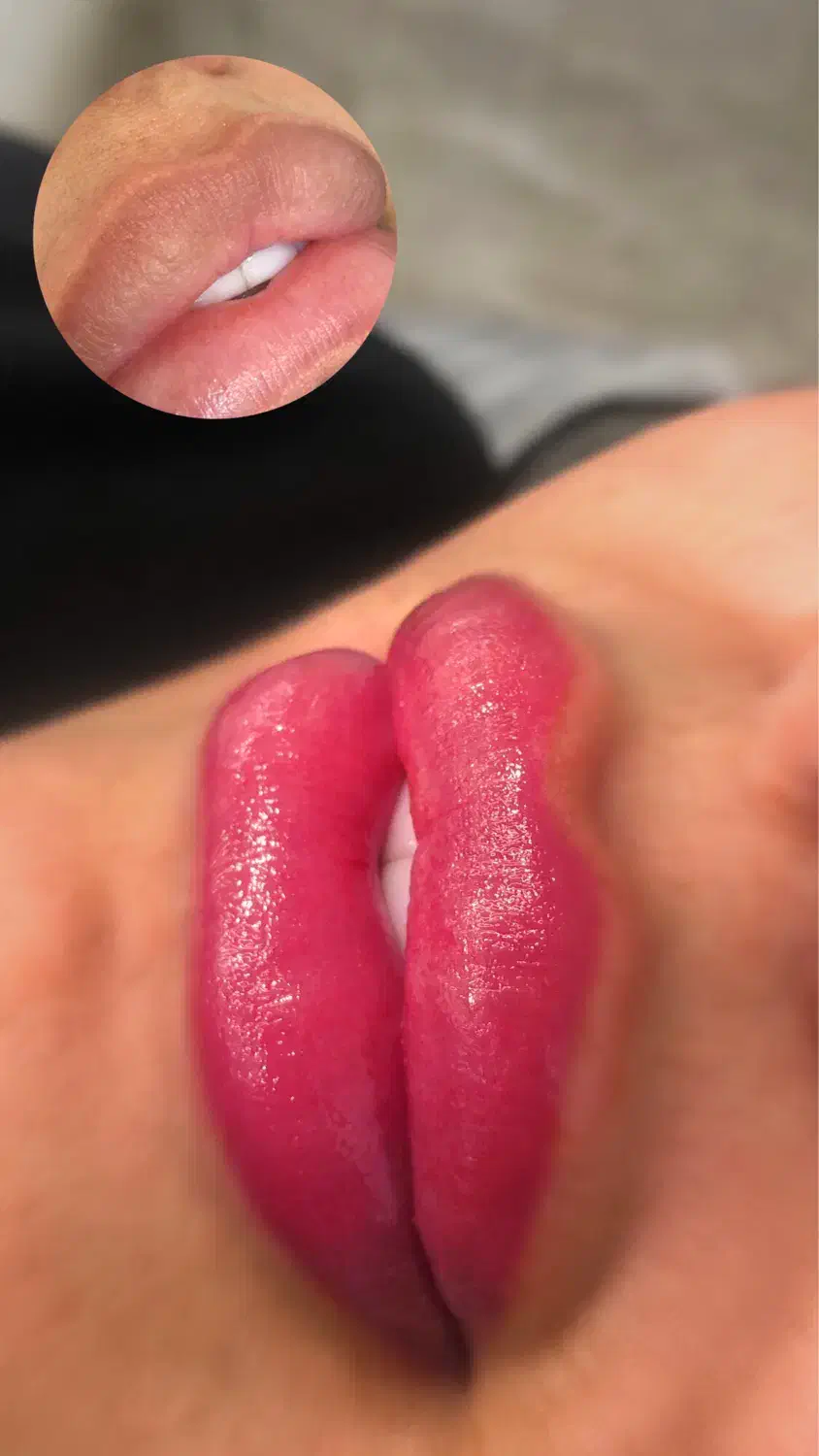 شیدینگ لب، درمان تیرگی لب (بدون درد)|خدمات آرایشگری و زیبایی|ساری, |دیوار