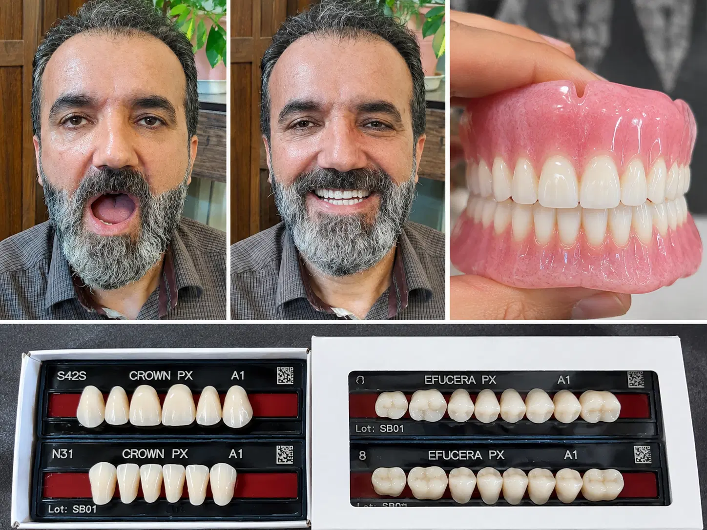 لابراتوار دندانسازی دنت یار|خدمات زیبایی و سلامت|تهران, شکوفه|دیوار