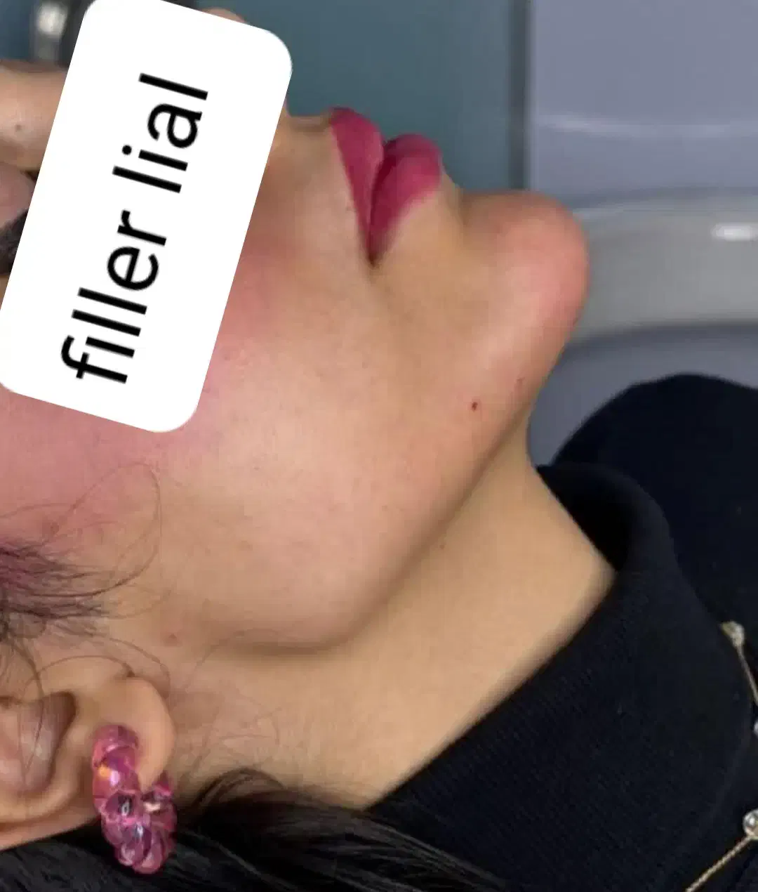 آف محدود ژل و بوتاکس فقط سی سی۴۵۰تا آخر هفته|خدمات آرایشگری و زیبایی|اهواز, پردیس|دیوار