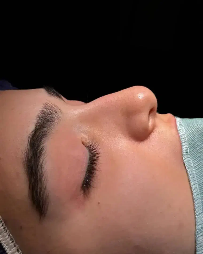 اف ویژه جراحی بینی در اهواز|خدمات آرایشگری و زیبایی|سوسنگرد, |دیوار