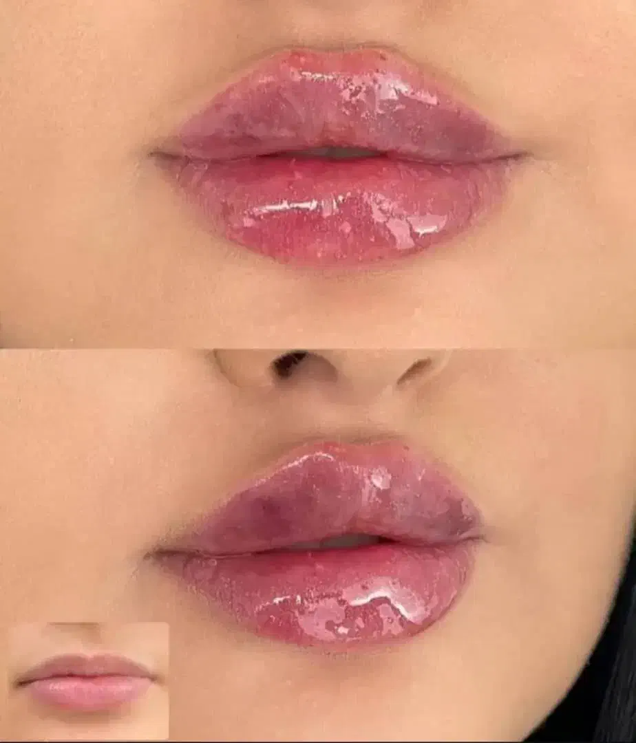 مرکز زیبایی بوتاکس و فیلر و تمامی خدمات زیبایی|خدمات آرایشگری و زیبایی|اصفهان, ملکشهر|دیوار