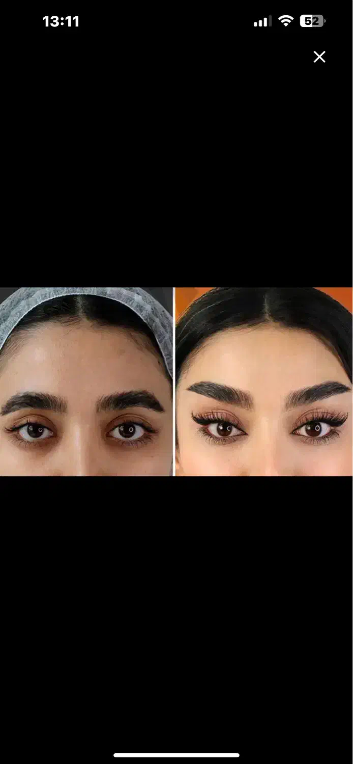 جشنواره تخفیف جراحی زیبایی شقیقه،بلفارو،دایرکت|خدمات آرایشگری و زیبایی|پرند, فاز ۲|دیوار