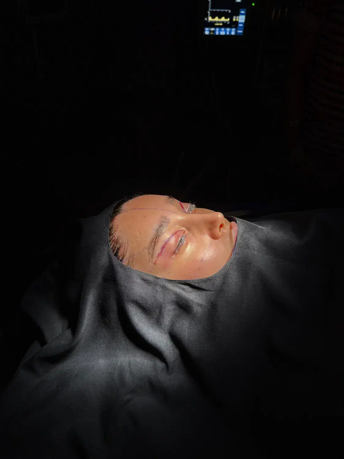 لیفت شقیقه توسط متخصص چشم تخفیف ویژه سه نفر اول|خدمات آرایشگری و زیبایی|تهران, تجریش|دیوار