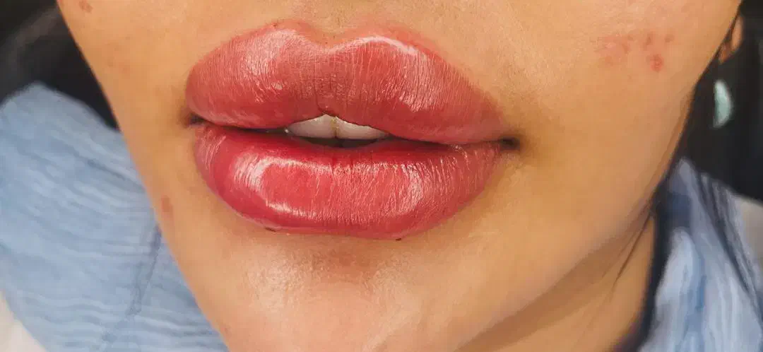 جشنواره فیلر بادی بدن باسن ممنوعه دست پا سی سی۱۸۰|خدمات آرایشگری و زیبایی|شیراز, شریفآباد|دیوار