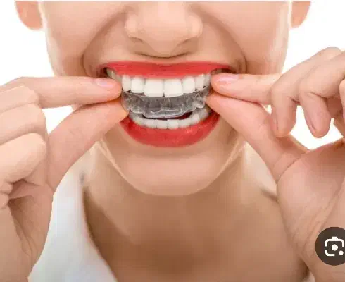 ارتودنسی شفاف الاینر|پزشکی|تهران, آسمان|دیوار