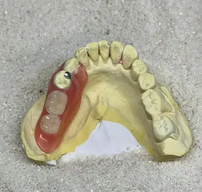 دندانسازی وساخت دندان بدون کام|آرایشی، بهداشتی، درمانی|زابل, |دیوار