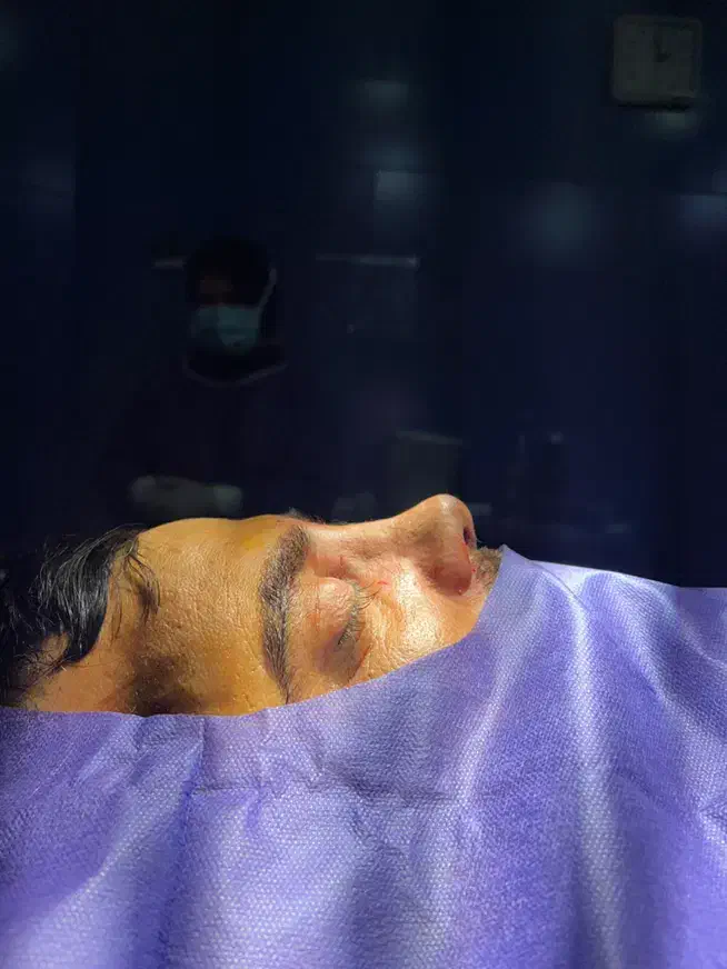 عمل بینی و لیفت صورت نقد و اقساط (بدون سود اضافه)|خدمات آرایشگری و زیبایی|تهران, الهیه|دیوار