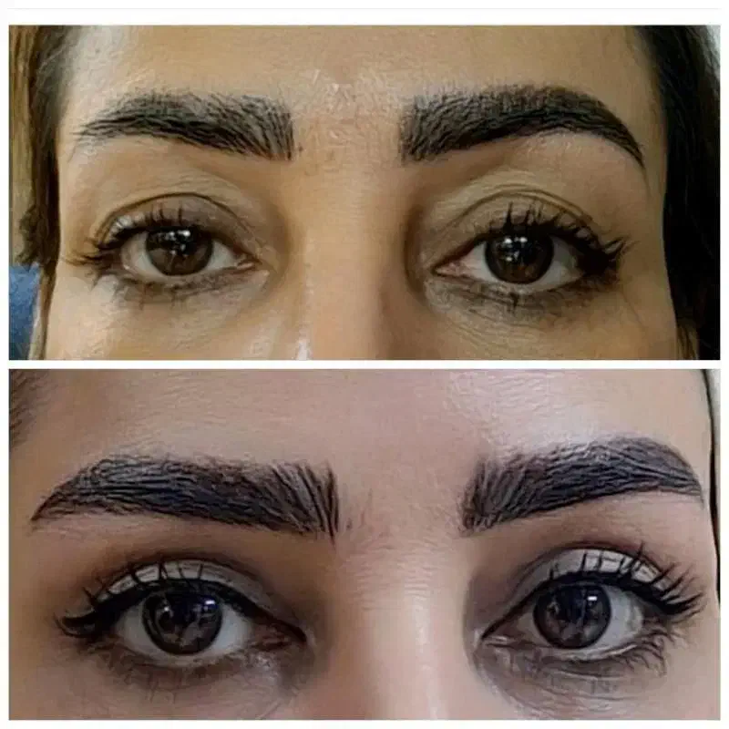 عمل جراحی پلک (بلفاروپلاستی)|خدمات آرایشگری و زیبایی|اصفهان, مسجد مصلی|دیوار