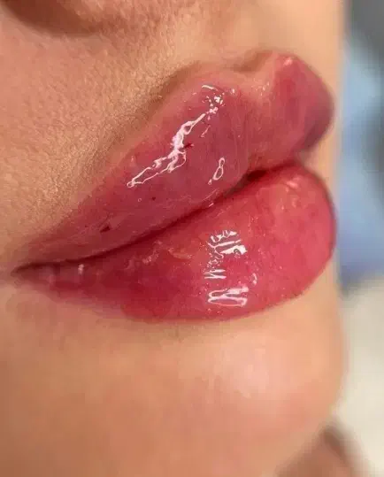 ژل لب، فیلر صورت، بوتاکس|خدمات آرایشگری و زیبایی|نجفآباد, امام خمینی|دیوار