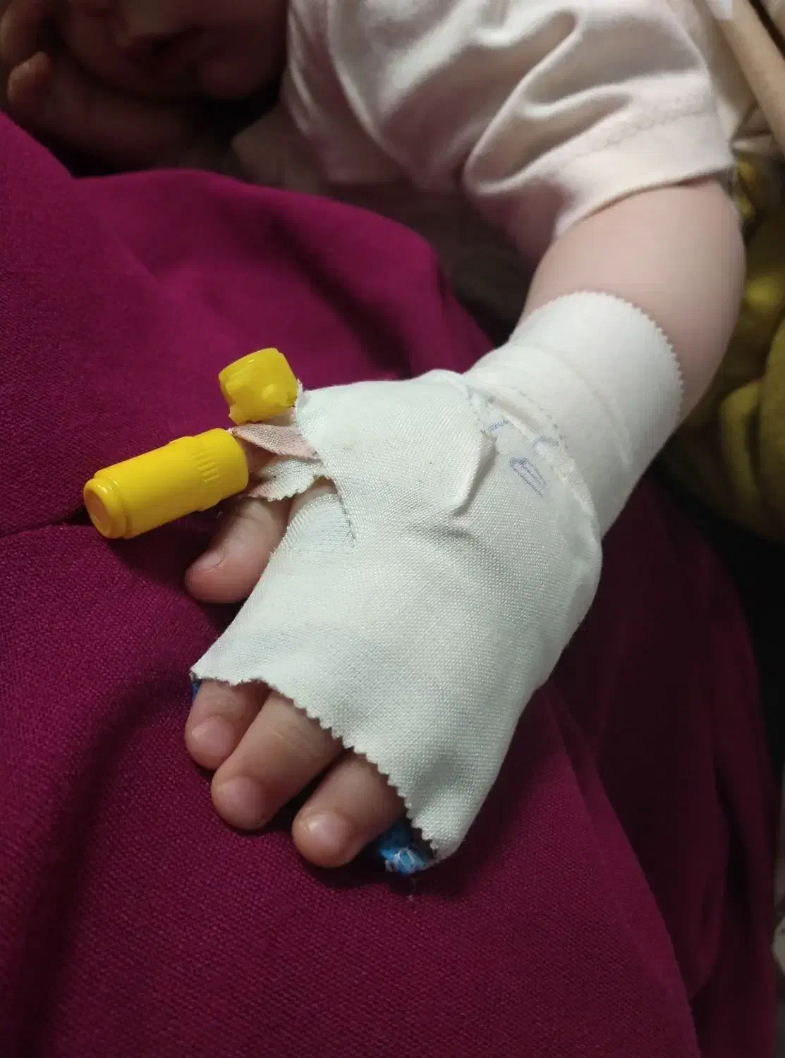 تزریقات و سرم تراپی و سونداژ در منزل توسط خانم|خدمات آرایشگری و زیبایی|تبریز, |دیوار