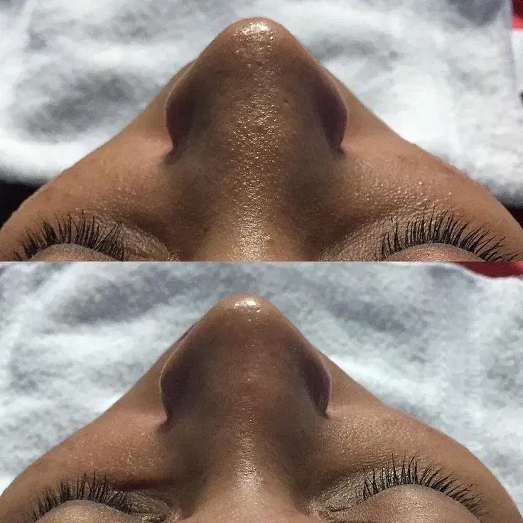 خدمات زیبایی پوست در کلینیک آیرال شهرک غرب|خدمات آرایشگری و زیبایی|تهران, دریا|دیوار