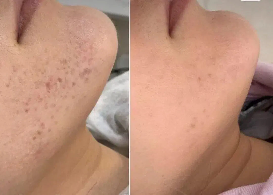 فشیال تخصصی|خدمات آرایشگری و زیبایی|تربت جام, بیست متری منبع آب|دیوار