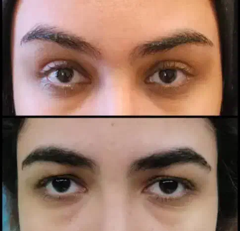 قسطی جراحی بینی و پیکرتراشی و لیفت صورت و ژل|خدمات آرایشگری و زیبایی|تبریز, |دیوار