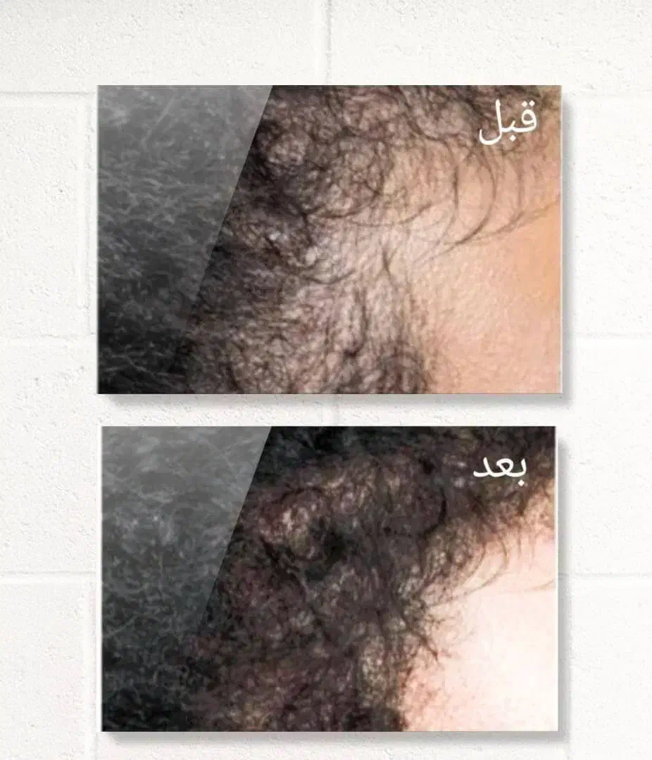 اکسیرپرپشتی مو ،مژه و ابرو|خدمات آرایشگری و زیبایی|گلبهار, شهر جدید گلبهار|دیوار