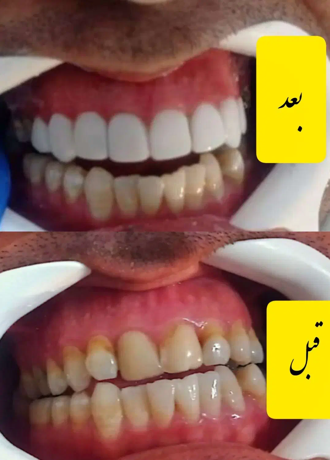 تخفیفات ویژه کامپوزیت در درمانگاه تخصصی یاسوج|خدمات آرایشگری و زیبایی|یاسوج, |دیوار