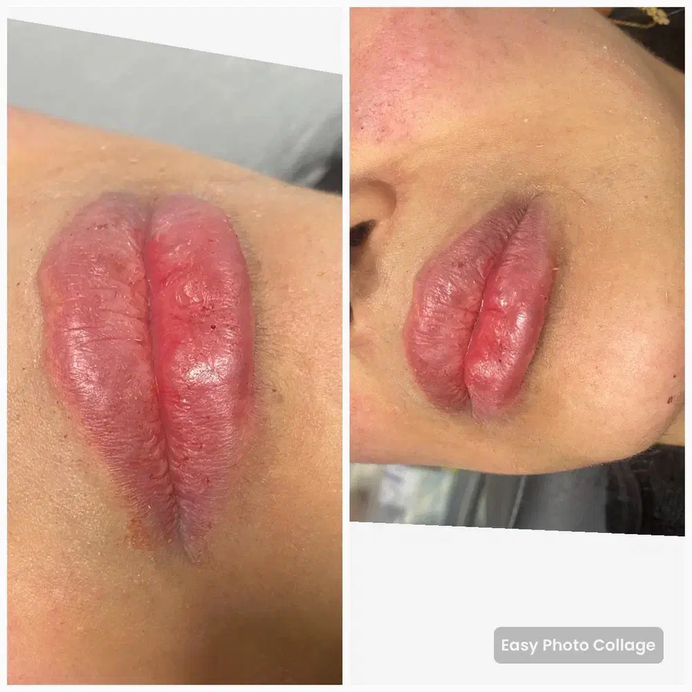 جشنواره تزریق ژل و بوتاکس در کلینیک فقط۶۰۰|خدمات آرایشگری و زیبایی|ساری, |دیوار