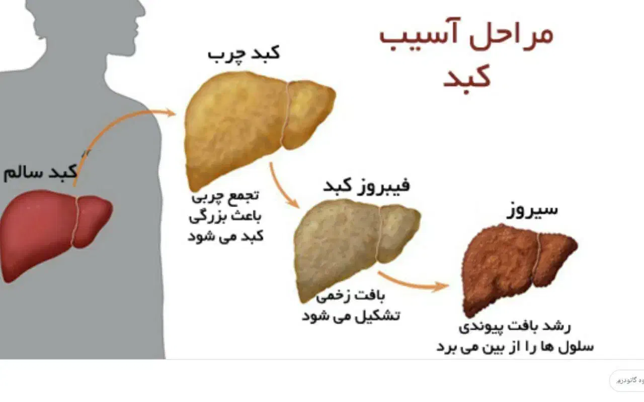 وایتکس کبد|خوردنی و آشامیدنی|قم, شهرک امام حسن|دیوار