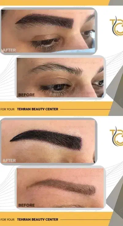 تور جراحی زیبایی بانوان|خدمات آرایشگری و زیبایی|ساری, |دیوار