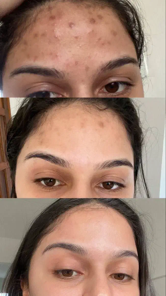 پاکسازی کبدچرب فقط در 40 روز|خدمات آرایشگری و زیبایی|گرگان, |دیوار