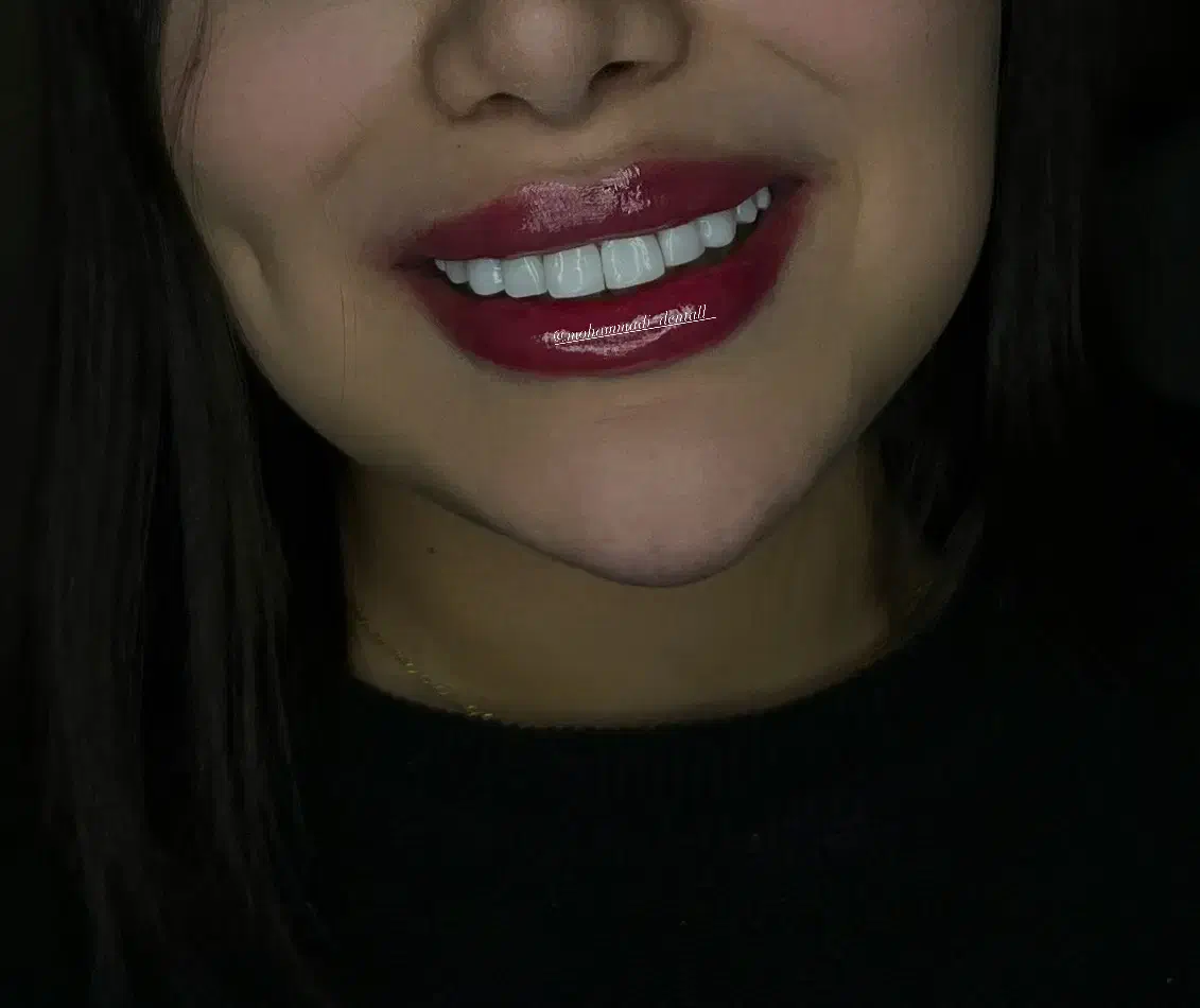 کامپوزیت زیبایی|خدمات آرایشگری و زیبایی|فومن, |دیوار