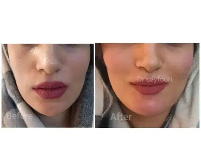 در کلینیک زیبایی ما توسط پزشک باسابقه زیباتر شوید|خدمات آرایشگری و زیبایی|قرچک, مهدیه|دیوار