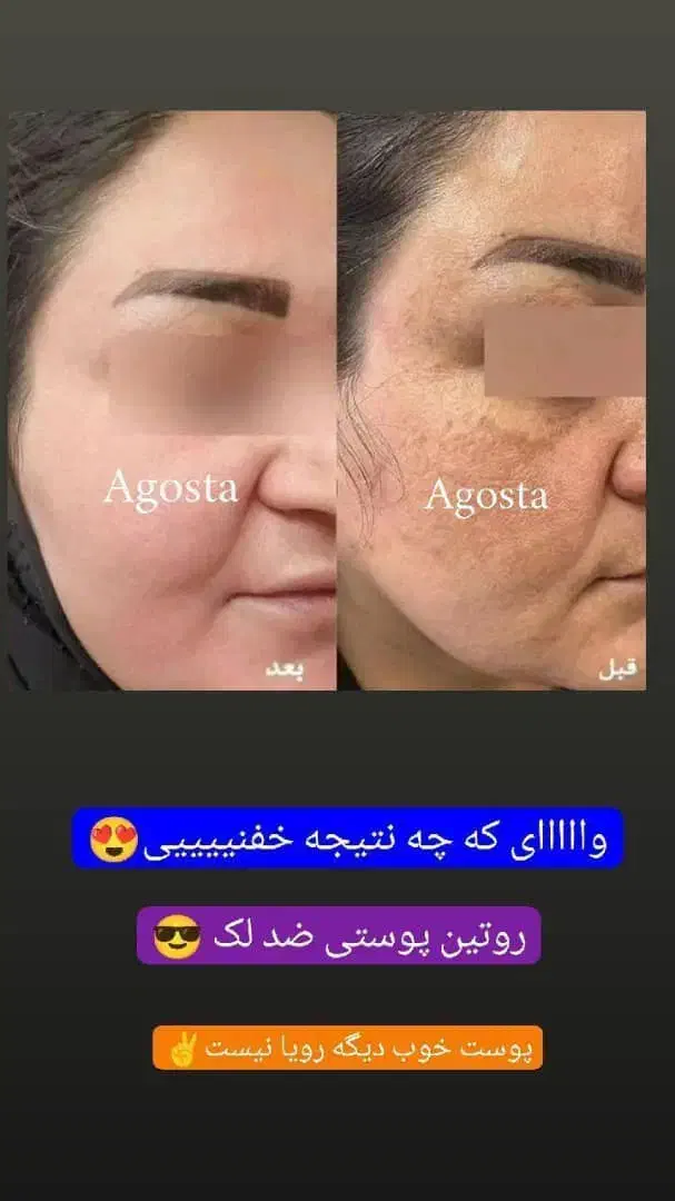 انواع سرم|آرایشی، بهداشتی، درمانی|شیراز, باجگاه|دیوار
