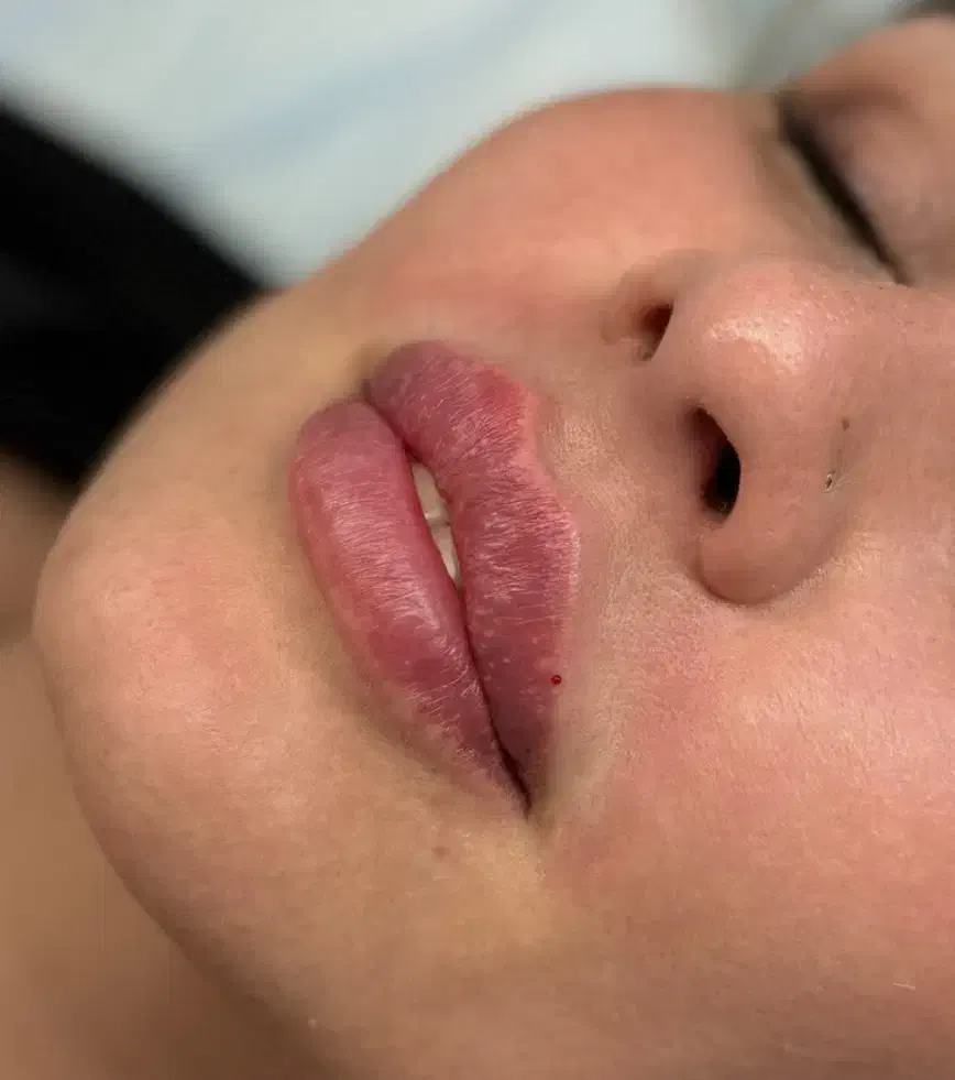 تخفیف ویژه بوتاکس فیلر و جوانسازی|خدمات آرایشگری و زیبایی|ورامین, خیر آباد|دیوار