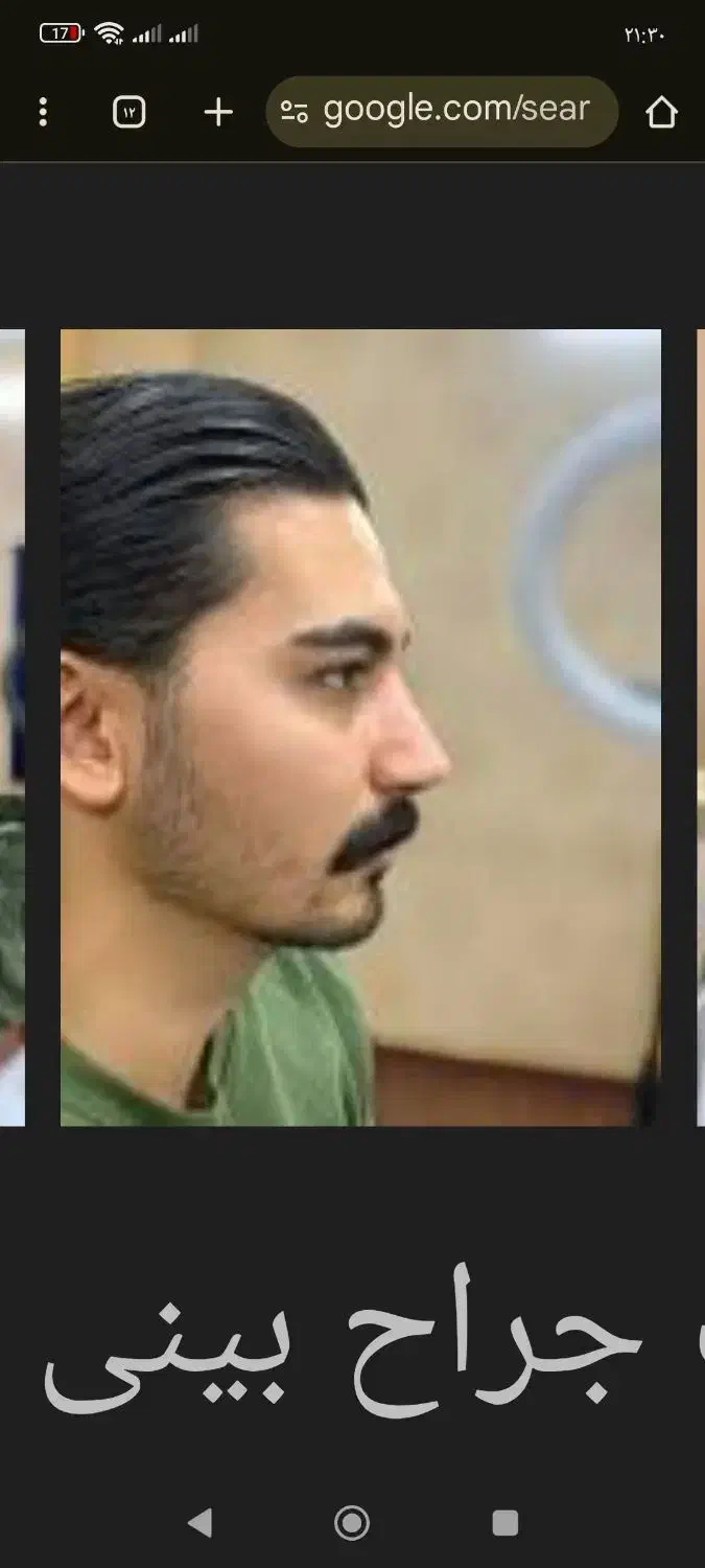 راهنمایی برای عمل بینی(دکتر خوب)|فعالیت داوطلبانه|محمدیه-قزوین, |دیوار