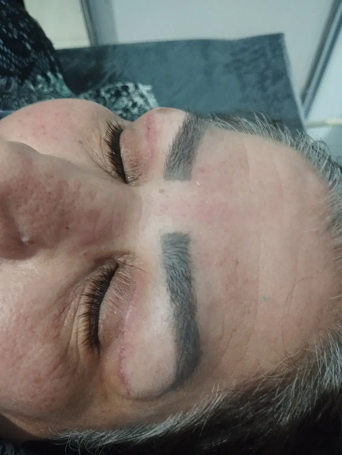 جراحی درمطب توسط پزشک جراح درخرم اباد|خدمات آرایشگری و زیبایی|دورود, |دیوار