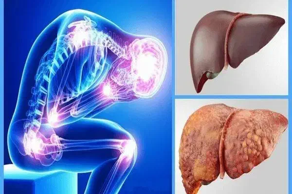 مشکل.گوارشی. کبد.چرب. چاقی|آرایشی، بهداشتی، درمانی|یزد, |دیوار