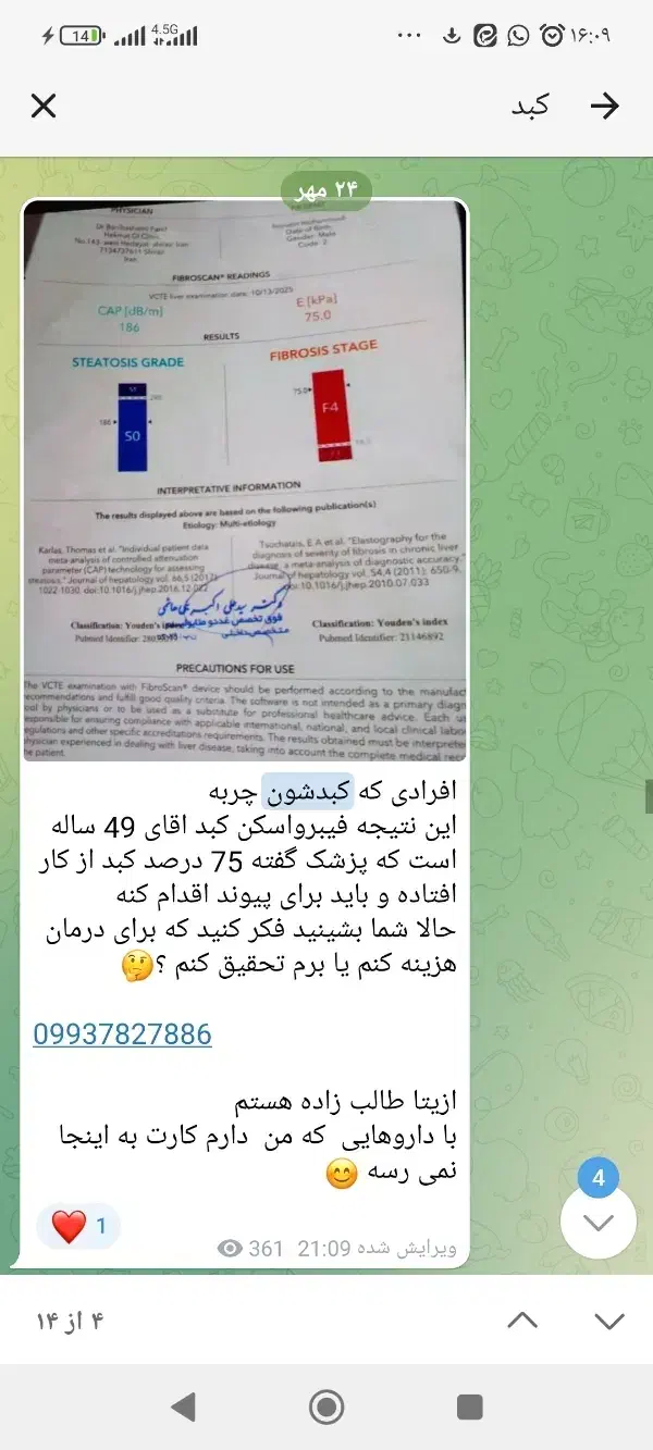 خطر سلامتی با کبد چرب|خدمات آرایشگری و زیبایی|تاکستان, |دیوار