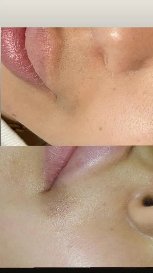 ژل لب و بدن|خدمات آرایشگری و زیبایی|خوی, |دیوار