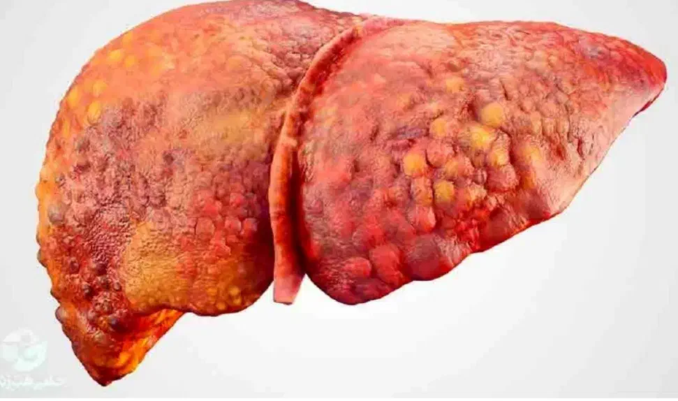 کبدپاک|آرایشی، بهداشتی، درمانی|گنبد کاووس, |دیوار