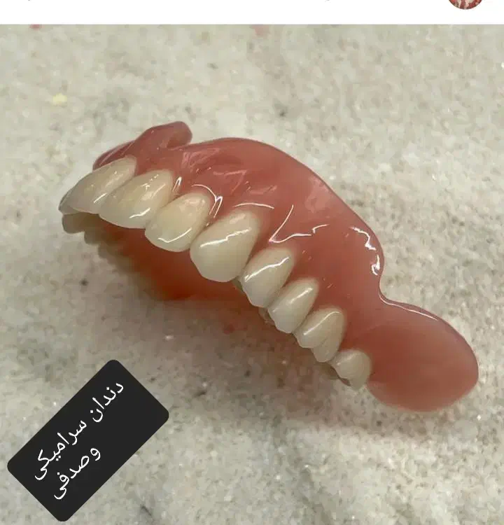 دندانسازی وساخت دندان بدون کام|آرایشی، بهداشتی، درمانی|زابل, |دیوار