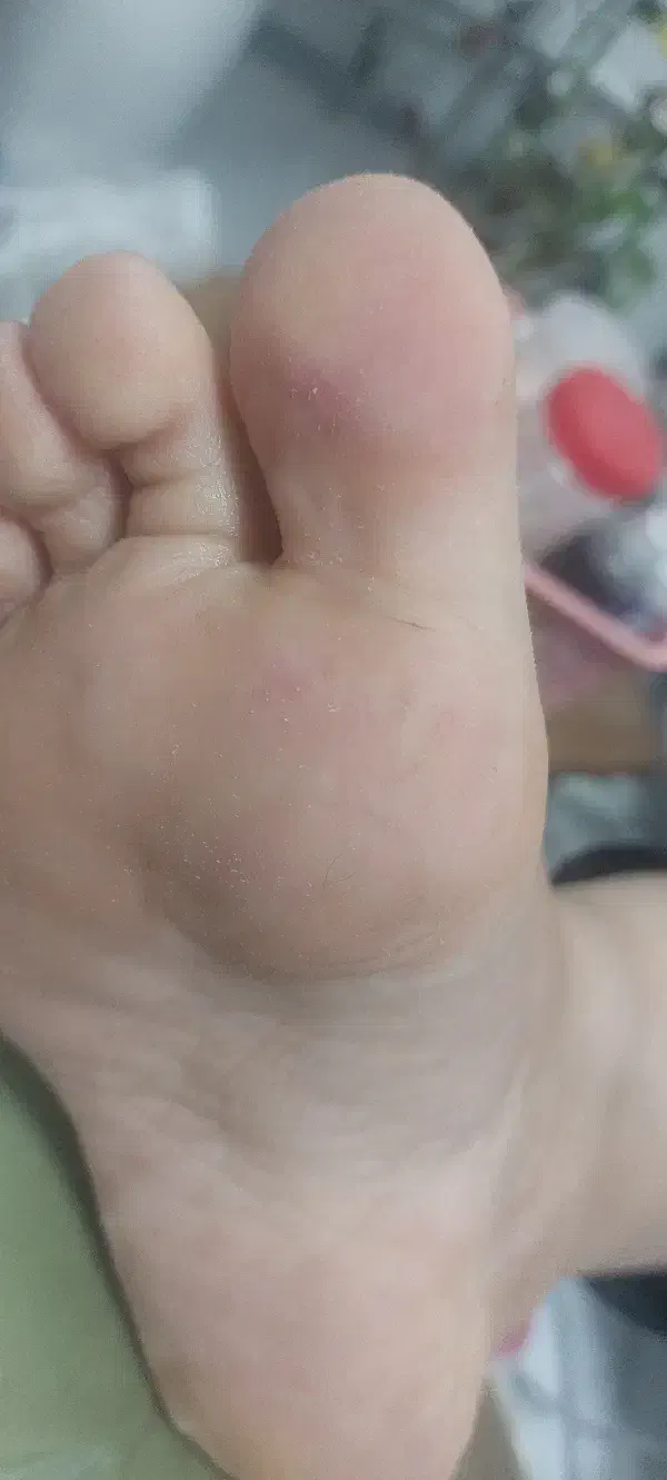 کفسابی درمانی فقط 450 در سالن زیبایی سمیرا محمدی|خدمات آرایشگری و زیبایی|اصفهان, نقش جهان|دیوار