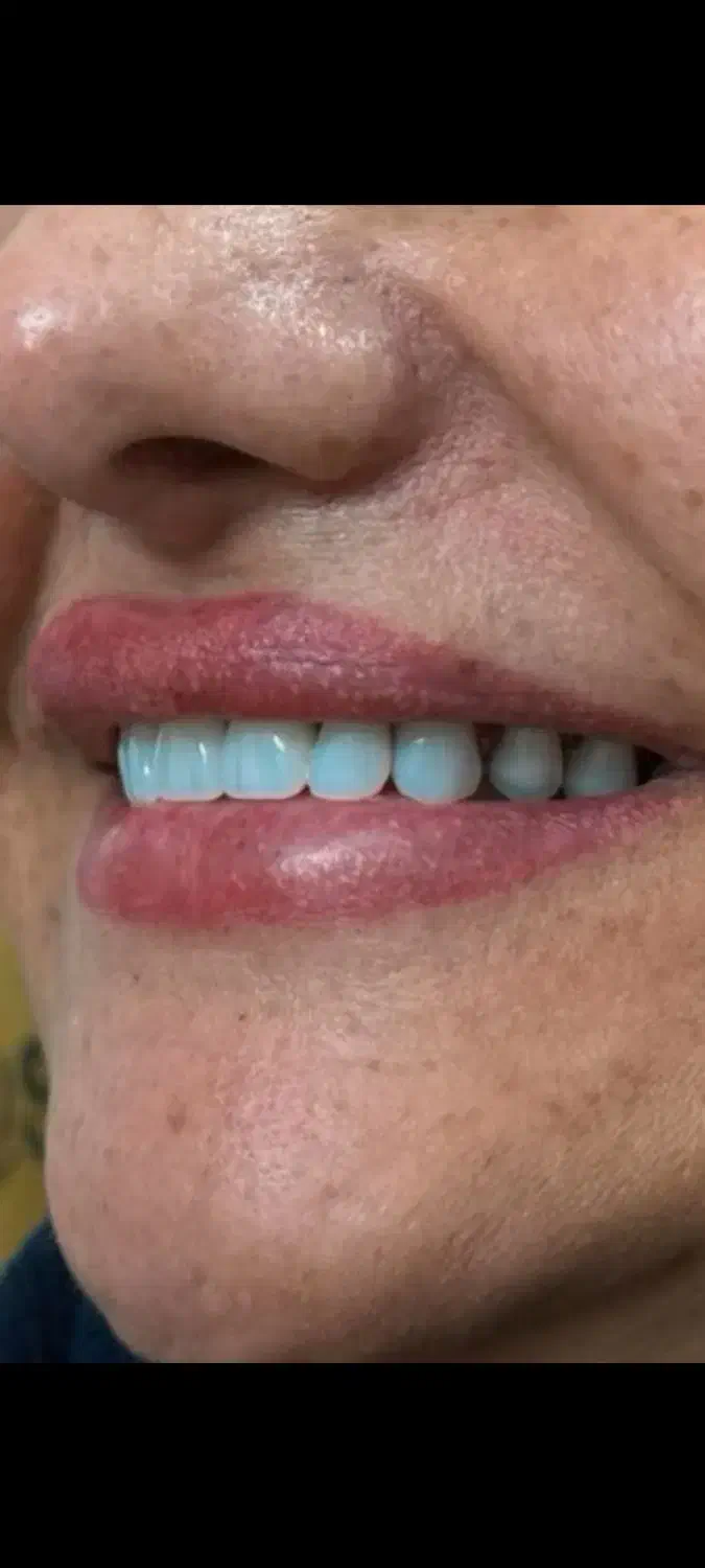 دندانسازی ساخت دندان مصنوعی|خدمات آرایشگری و زیبایی|خرمآباد, |دیوار