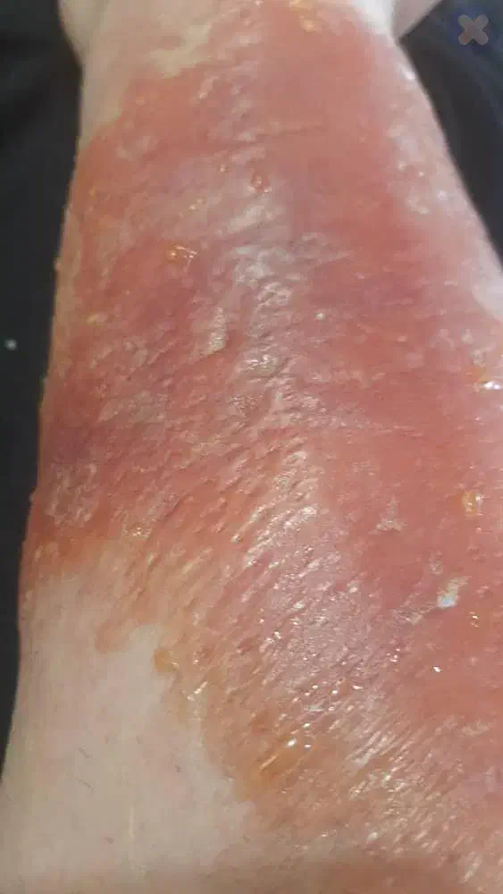 بهترین جراح و کارشناس زخم ایران|خدمات آرایشگری و زیبایی|تهران, جهاد|دیوار