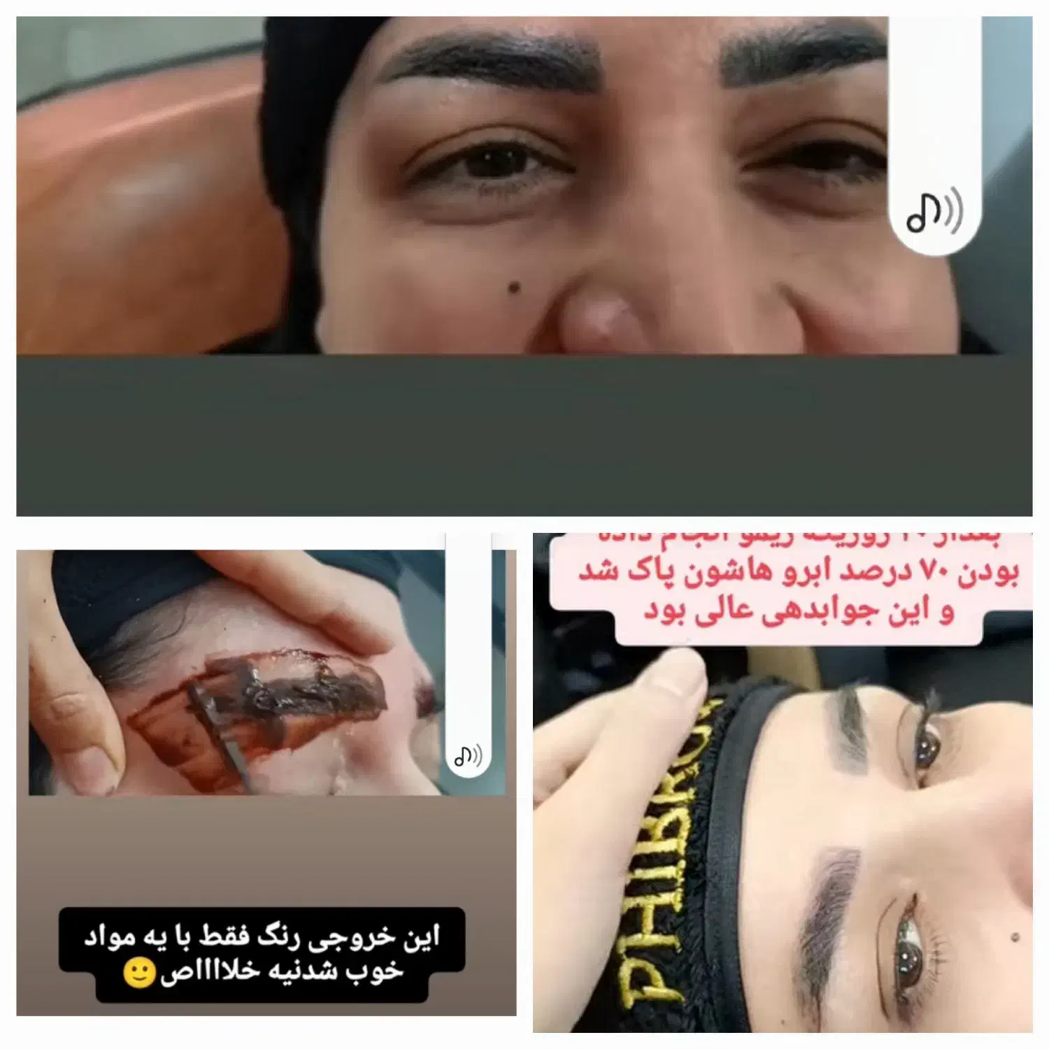 ریموو ابرو بصورت تخصصی بدون آسیب بدون درد|خدمات آرایشگری و زیبایی|بروجرد, |دیوار