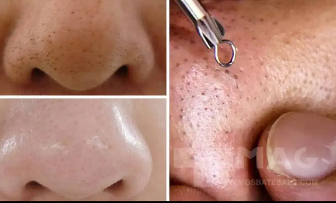 فیشیال کلاسیک|خدمات آرایشگری و زیبایی|دهدشت, |دیوار