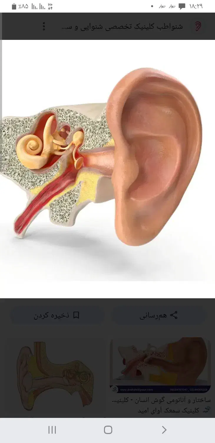 وز وز گوش|آرایشی، بهداشتی، درمانی|ایلام, |دیوار