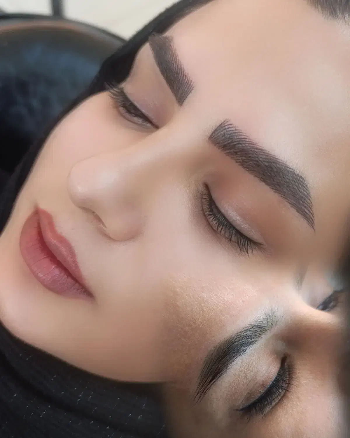 تخفیف ویژه میکرووژل بوتاکس|خدمات آرایشگری و زیبایی|بیرجند, |دیوار