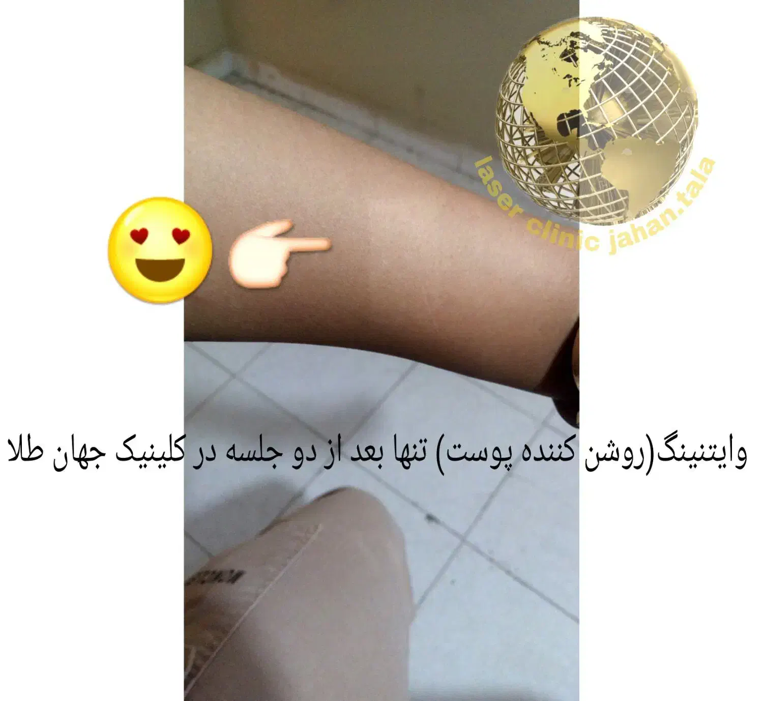 کلینیک لیزر پوست،مو جهانطلا در کرمانشاه (فوتونا)|خدمات آرایشگری و زیبایی|کرمانشاه, |دیوار